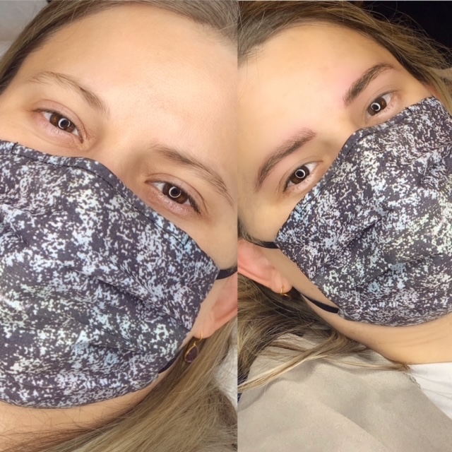 Microblading Before And After Pictures