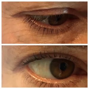 IMG_0068 lash lift close up before and after